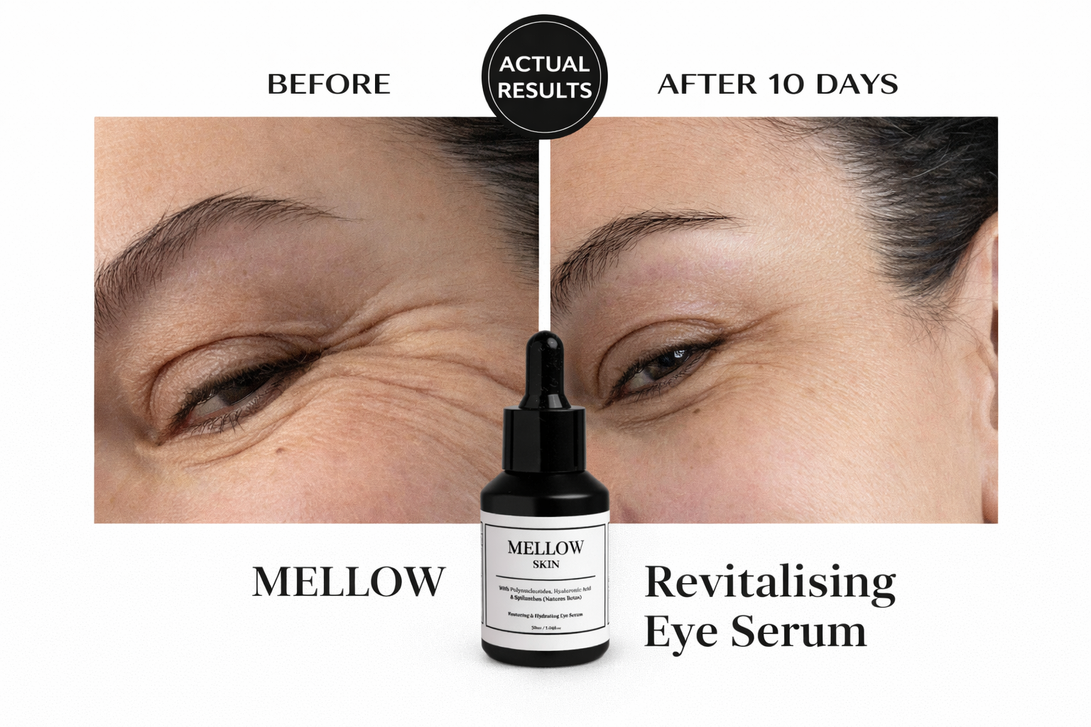 The Ultimate Skin Trio - Get your Hyaluronic Acid Tablets FREE (worth £25)
