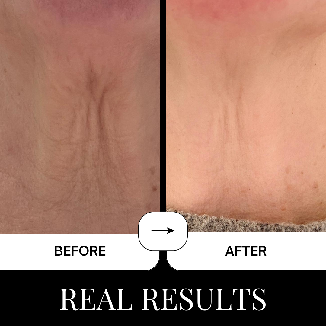 Mellow Skin Restoring Face &amp; Neck Cream (Salmon DNA)