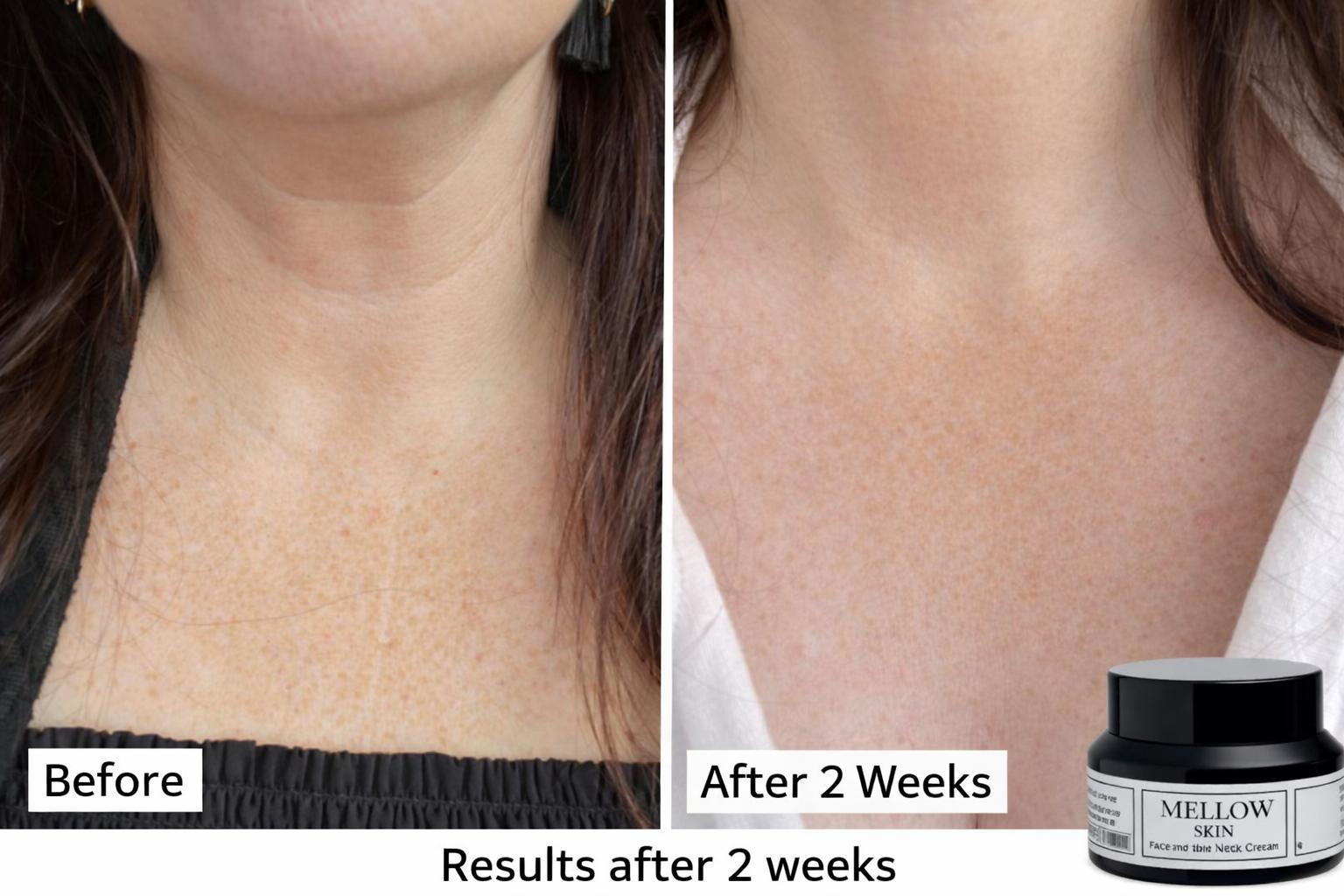 Mellow Skin Restoring Face &amp; Neck Cream (Salmon DNA)