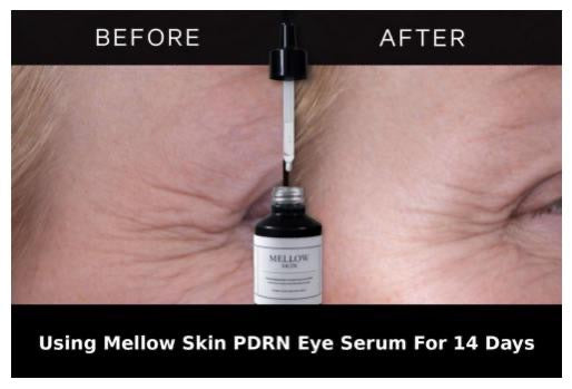 The Ultimate Skin Trio - Get your Hyaluronic Acid Tablets FREE (worth £25)