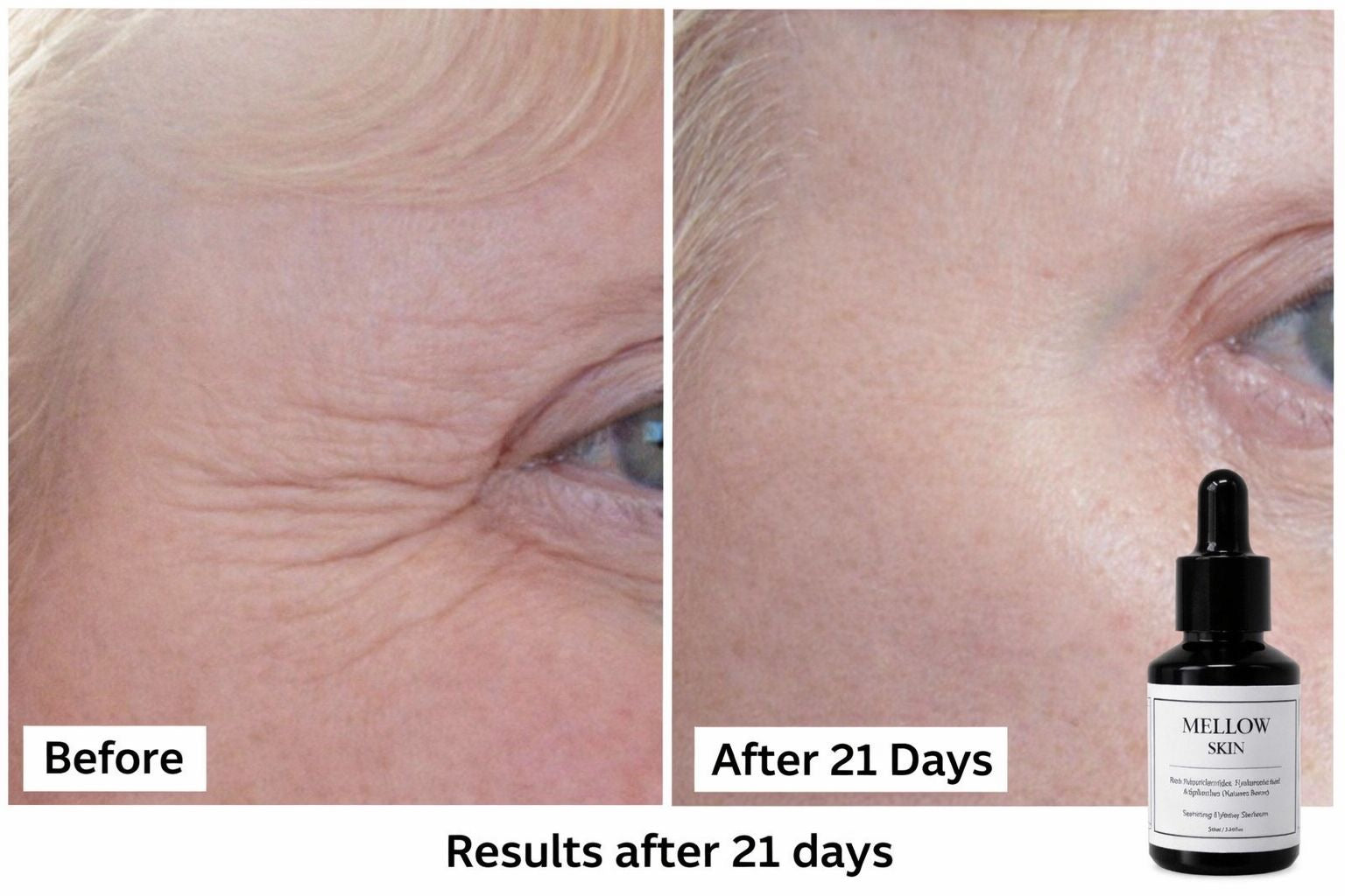 The Ultimate Skin Trio - Get your Hyaluronic Acid Tablets FREE (worth £25)